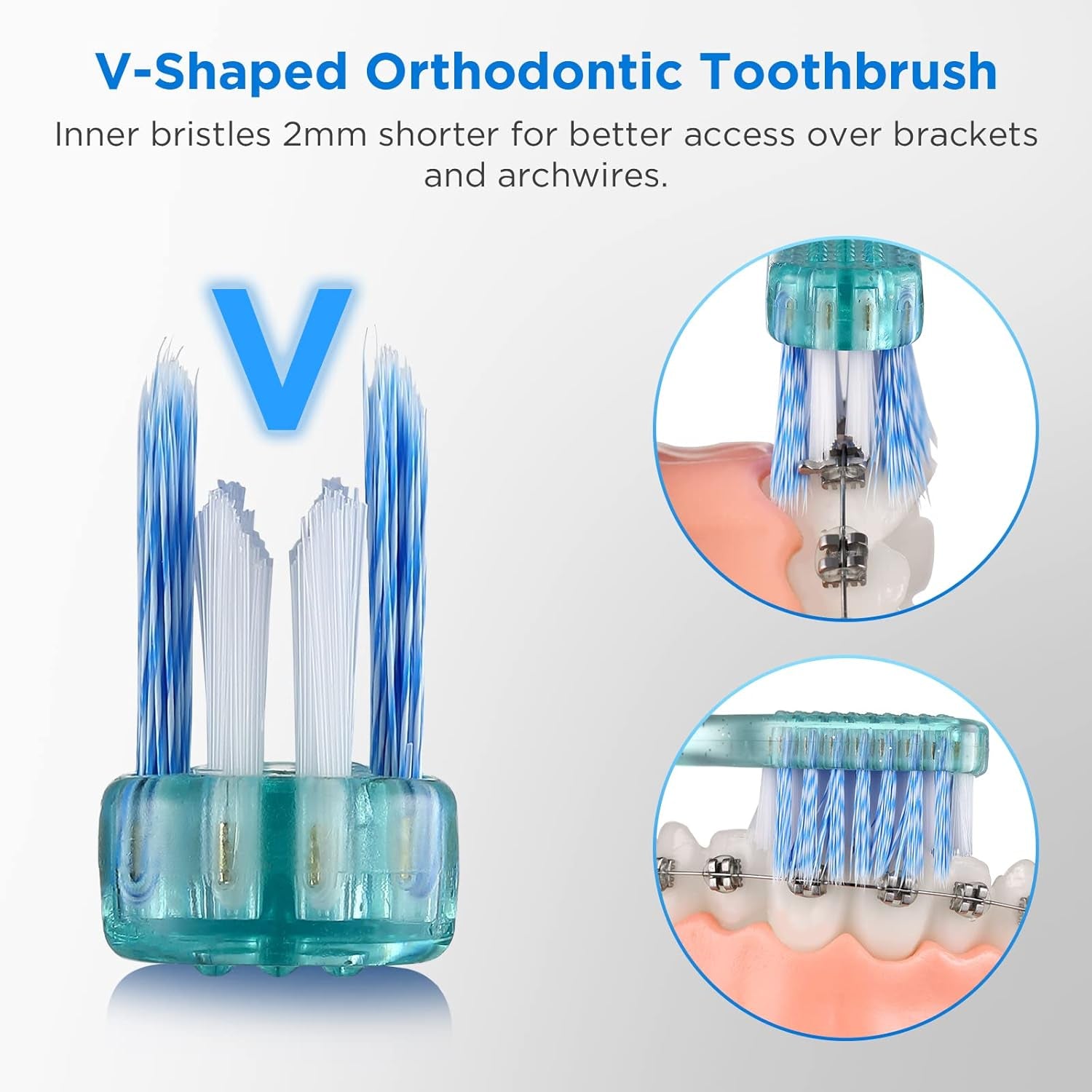 V-Shaped Orthodontic Toothbrush for Braces, Soft Bristles, 6 Count, No Interdental Brushes Included