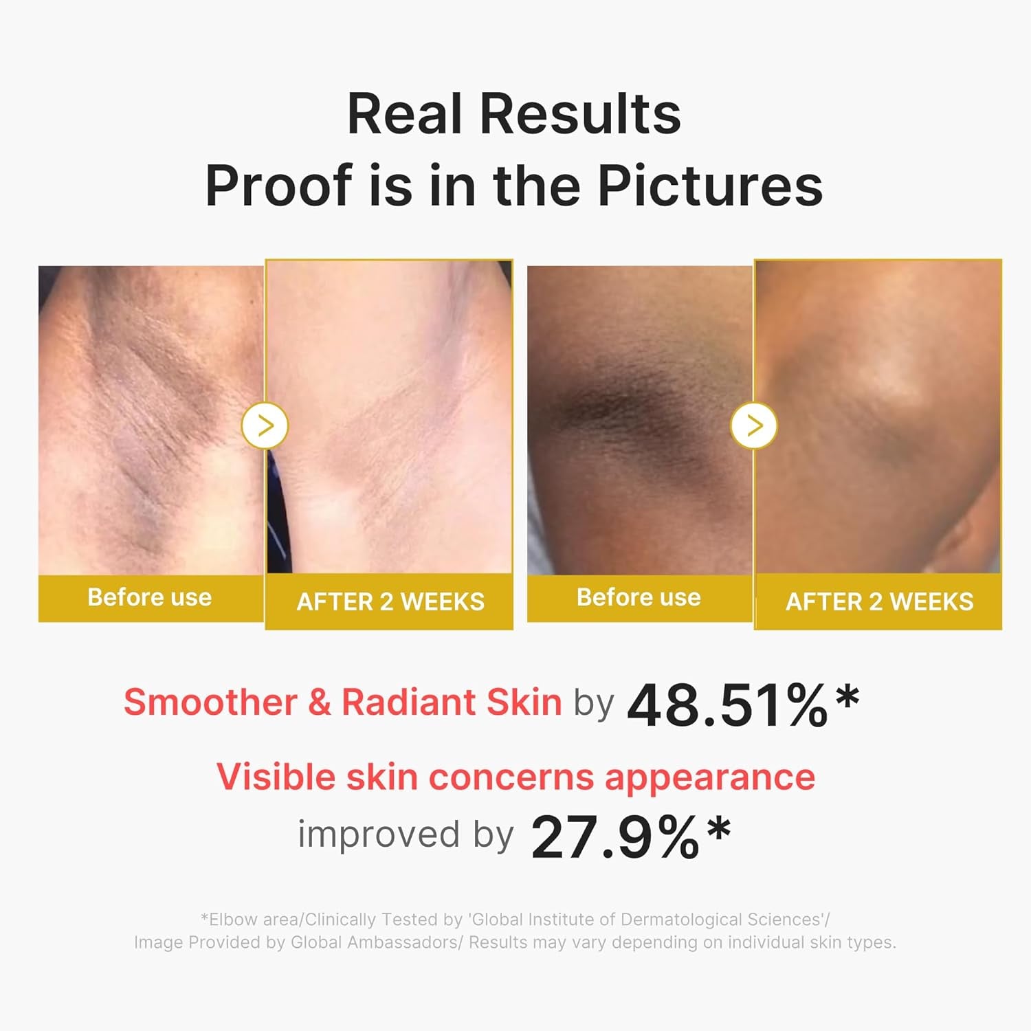 Body Peel Shot with Kojic Acid and Turmeric | Gentle Body Brightening & Exfoliating Serum with BHA, LHA & PHA for Dead Skin Cells, Uneven Looking Skin & Excess Sebum | 9.46 Fl.Oz