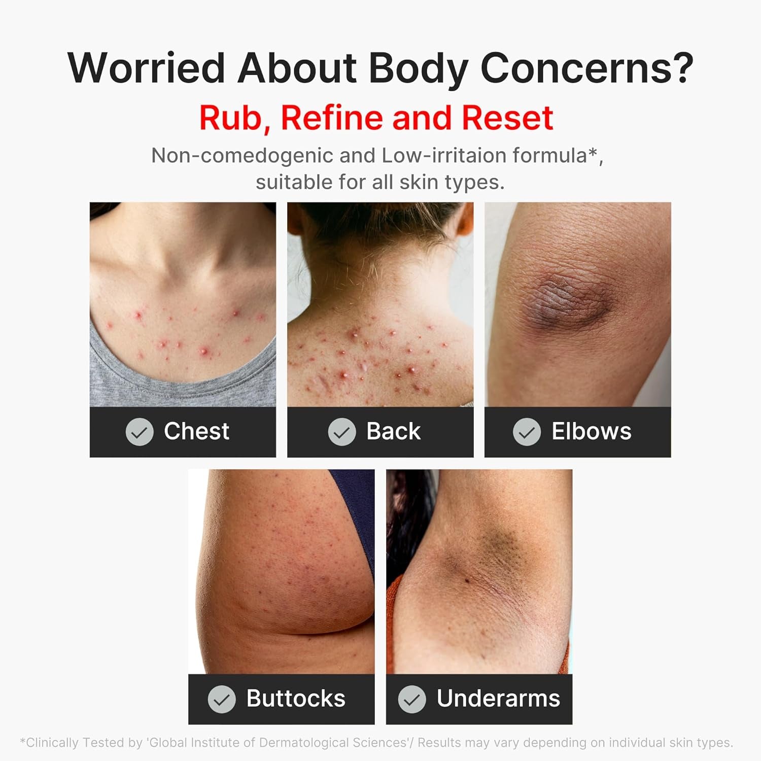 Body Peel Shot with Kojic Acid and Turmeric | Gentle Body Brightening & Exfoliating Serum with BHA, LHA & PHA for Dead Skin Cells, Uneven Looking Skin & Excess Sebum | 9.46 Fl.Oz